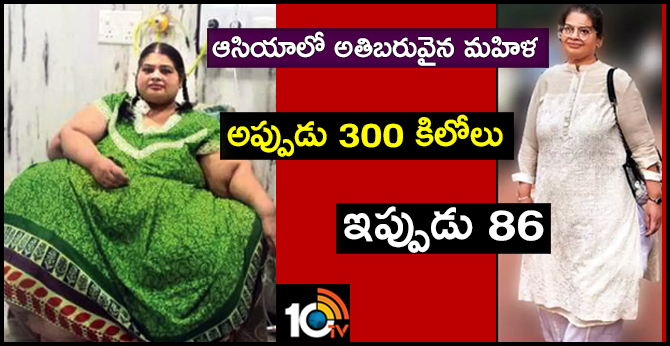 From 300 kg to 86 kg: Pune woman undergoes 2 weight loss surgeries