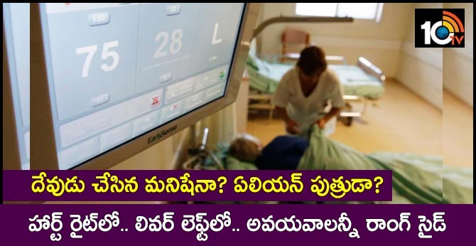 Shocking! 'Heart on right, liver on left'; this UP man has all organs on wrong side