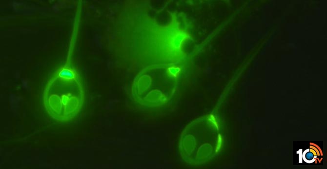 First Ever Seen Animal That Doesn't Need Oxygen to Survive, Scientists Found