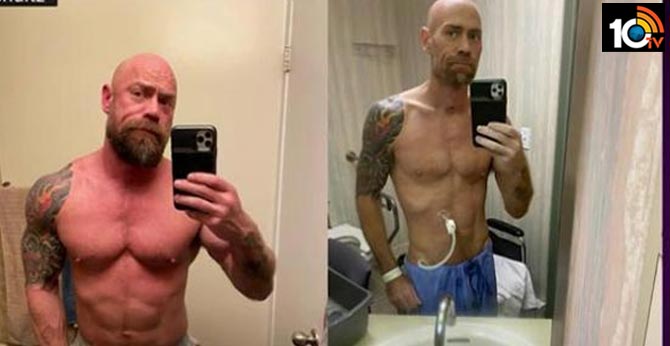 Before and after corona causes massive weight loss in a californian bodybuilder